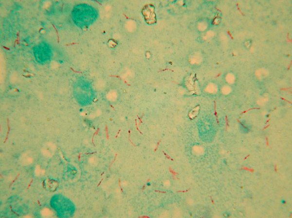 TB under the microscope - Bovine TB